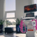 siemens_acuson_juniper-rear